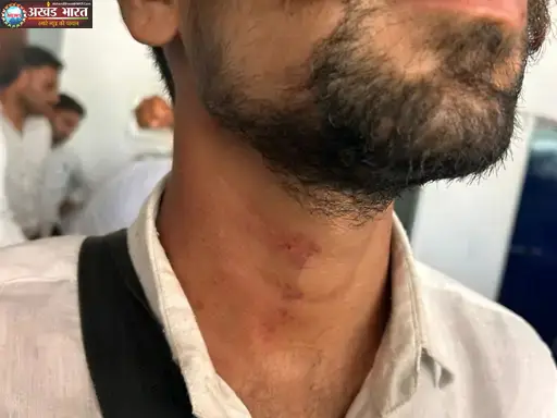 ग्रामीण कृषि विस्तार